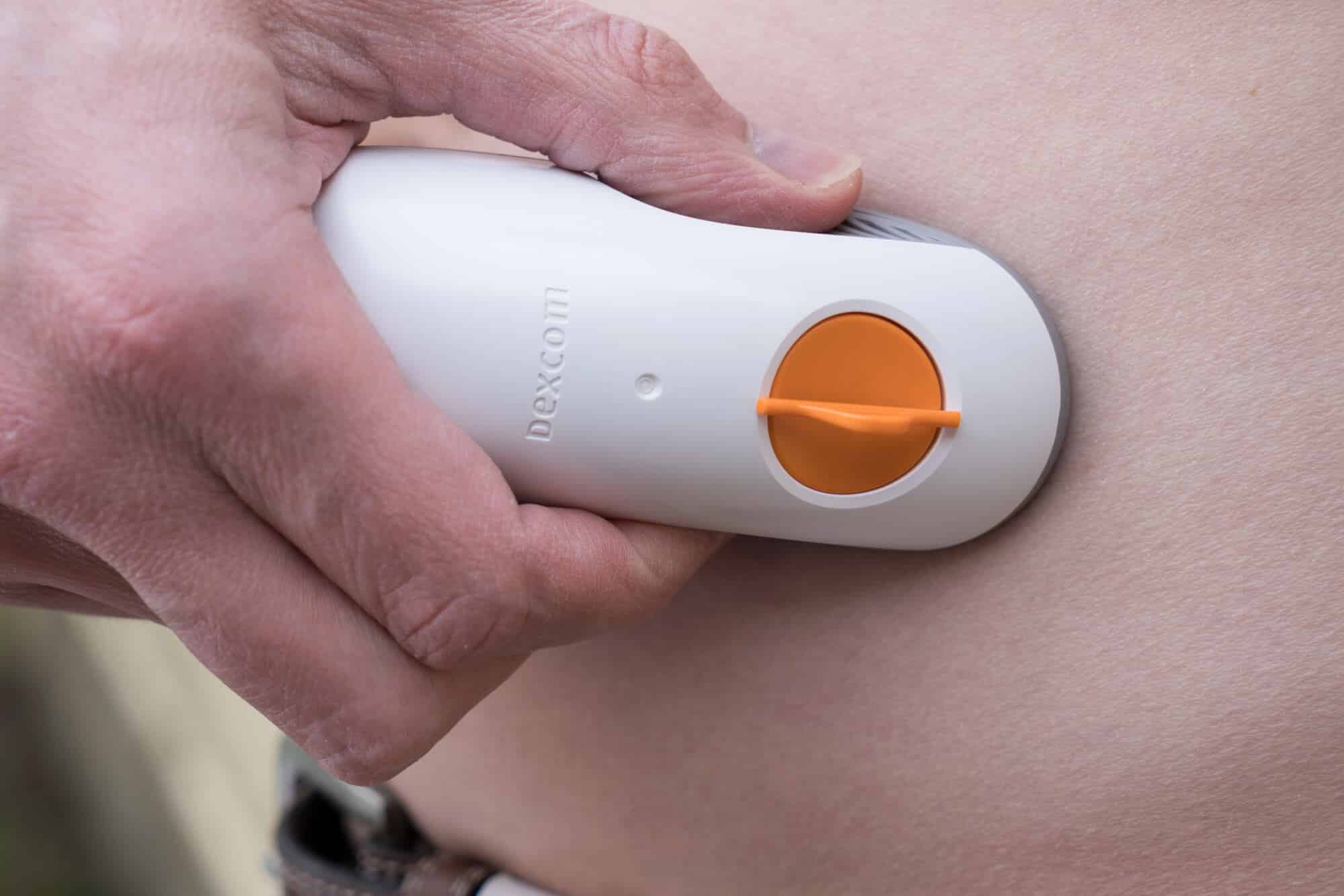 Where To Wear Dexcom G6